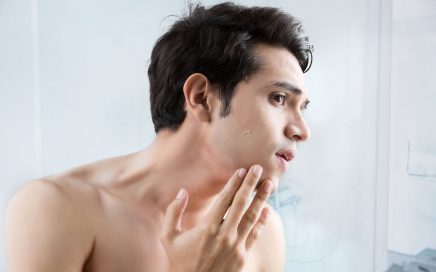 Man without spots after shaving
